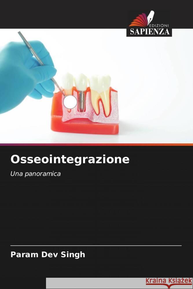 Osseointegrazione Param Dev Singh Varun Kumar Geeta Arya 9786204929132 Edizioni Sapienza - książka