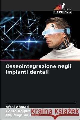 Osseointegrazione negli impianti dentali Afzal Ahmad Geeta Rajput MD Mojahid Anwar 9786205678275 Edizioni Sapienza - książka