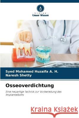 Osseoverdichtung Syed Mohamed Huzaifa A H Naresh Shetty  9786206047940 Verlag Unser Wissen - książka