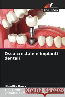 Osso crestale e impianti dentali Nivedita Bawa, S P Singh, Chandan Kumar Kusum 9786205368923 Edizioni Sapienza - książka