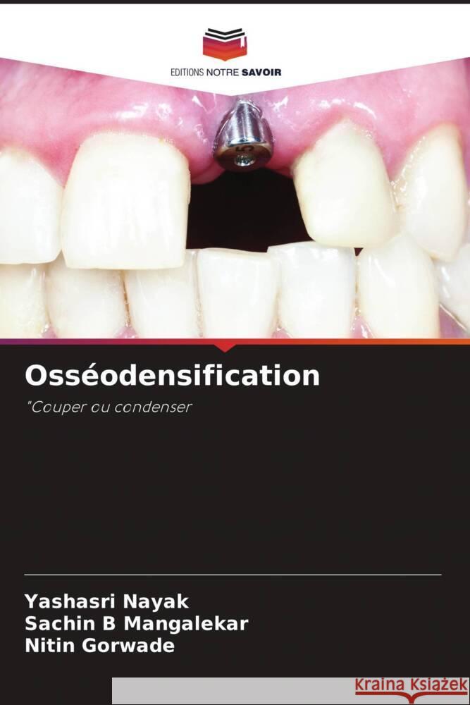 Oss?odensification Yashasri Nayak Sachin B. Mangalekar Nitin Gorwade 9786206892939 Editions Notre Savoir - książka