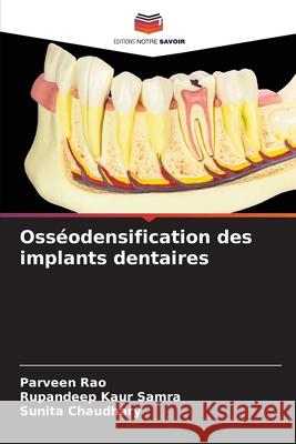 Osséodensification des implants dentaires Rao, Parveen, Samra, Rupandeep Kaur, Chaudhary, Sunita 9786209390302 Editions Notre Savoir - książka