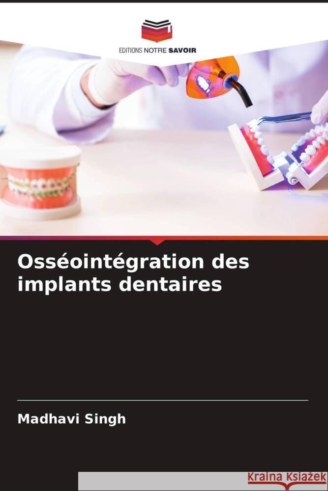 Osséointégration des implants dentaires Singh, Madhavi 9786205253502 Editions Notre Savoir - książka