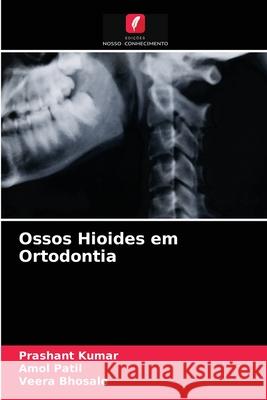 Ossos Hioides em Ortodontia Prashant Kumar, Amol Patil, Veera Bhosale 9786203596885 Edicoes Nosso Conhecimento - książka