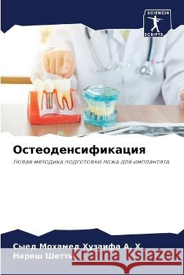 Osteodensifikaciq A. H., Syed Mohamed Huzaifa, Shetty, Naresh 9786206047988 Sciencia Scripts - książka