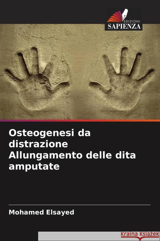 Osteogenesi da distrazione Allungamento delle dita amputate Elsayed, Mohamed 9786208199142 Edizioni Sapienza - książka