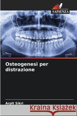 Osteogenesi per distrazione Arpit Sikri 9786207876464 Edizioni Sapienza - książka