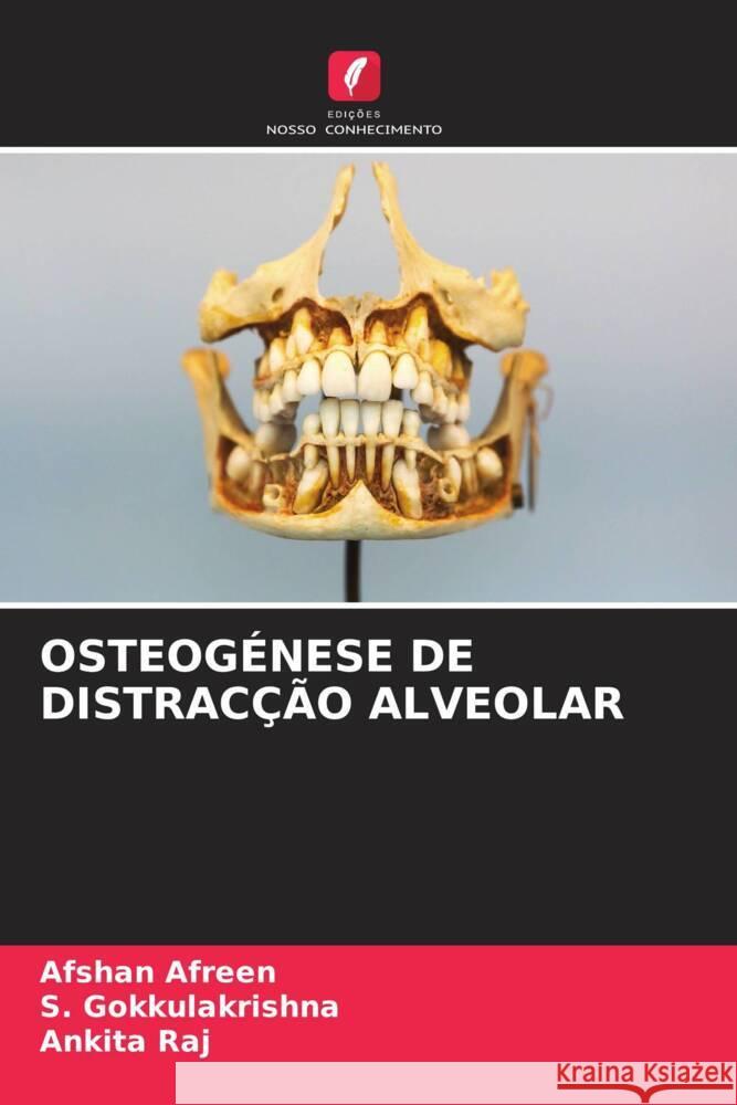 OSTEOGÉNESE DE DISTRACÇÃO ALVEOLAR Afreen, Afshan, Gokkulakrishna, S., Raj, Ankita 9786204415079 Edições Nosso Conhecimento - książka