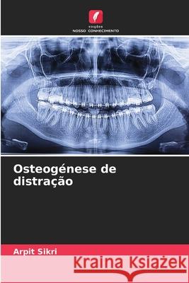 Osteog?nese de distra??o Arpit Sikri 9786207876471 Edicoes Nosso Conhecimento - książka