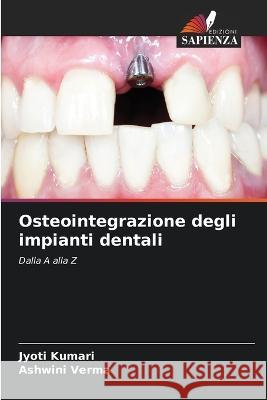 Osteointegrazione degli impianti dentali Jyoti Kumari Ashwini Verma 9786205712504 Edizioni Sapienza - książka