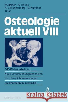 Osteologie Aktuell VIII: 3-D-Bildverarbeitung, Neue Untersuchungstechniken Knochendichtemessung, Medikamentöse Einflüsse Reiser, Maximilian 9783540574972 Not Avail - książka