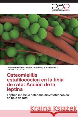 Osteomielitis estafilocócica en la tibia de rata: Acción de la leptina Hernández Flores, Cecilia 9783659072451 Editorial Academica Espanola - książka