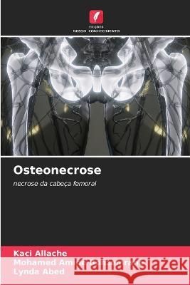 Osteonecrose Kaci Allache Mohamed Amine Benzemrane Lynda Abed 9786205923757 Edicoes Nosso Conhecimento - książka