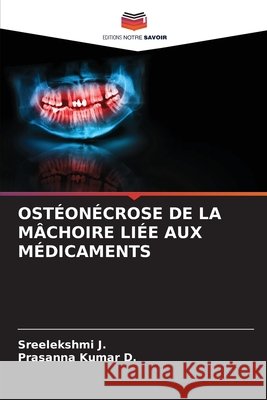 Ostéonécrose de la Mâchoire Liée Aux Médicaments J, Sreelekshmi, D, Prasanna Kumar 9786209826566 Editions Notre Savoir - książka
