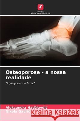 Osteoporose - a nossa realidade Hadziavdic, Aleksandra, Gavric, Nikola 9786208950897 Edições Nosso Conhecimento - książka
