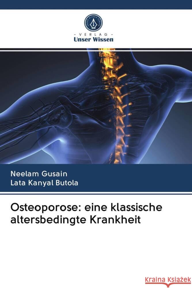 Osteoporose: eine klassische altersbedingte Krankheit Gusain, Neelam, Kanyal Butola, Lata 9786203022407 Verlag Unser Wissen - książka