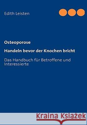 Osteoporose: Handeln bevor der Knochen bricht Leisten, Edith 9783839163825 Books on Demand - książka