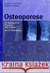 Osteoporose: Leitliniengerechte Diagnostik und Therapie mit 25 Fallbeispielen Peters, Klaus M. 9783798514652 Steinkopff-Verlag Darmstadt - książka