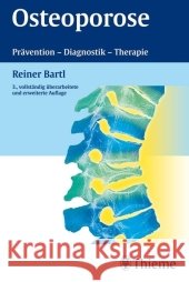 Osteoporose : Prävention - Diagnostik - Therapie Bartl, Reiner   9783131057549 Thieme, Stuttgart - książka
