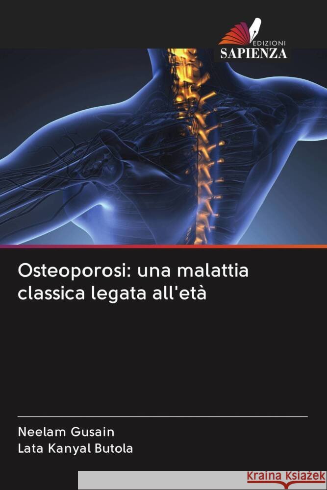 Osteoporosi: una malattia classica legata all'età Gusain, Neelam, Kanyal Butola, Lata 9786203022438 Edizioni Sapienza - książka
