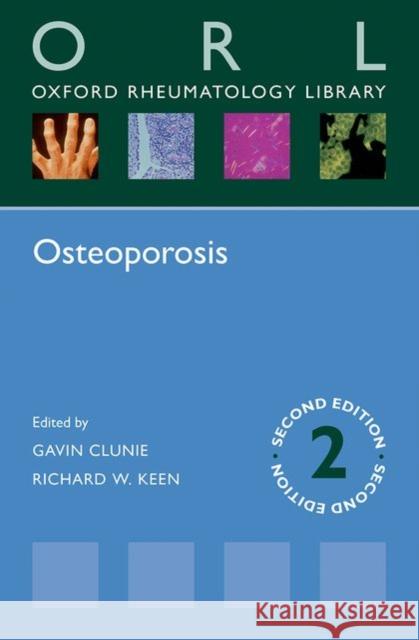 Osteoporosis Gavin Clunie Richard Keen 9780198713340 Oxford University Press, USA - książka