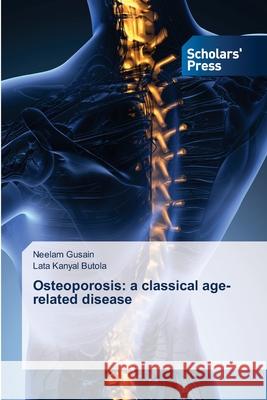 Osteoporosis: a classical age-related disease Neelam Gusain, Lata Kanyal Butola 9786138942238 Scholars' Press - książka