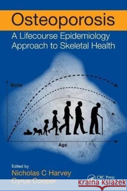 Osteoporosis: A Lifecourse Epidemiology Approach to Skeletal Health Nicholas C. Harvey Cyrus Cooper 9781138196162 CRC Press - książka
