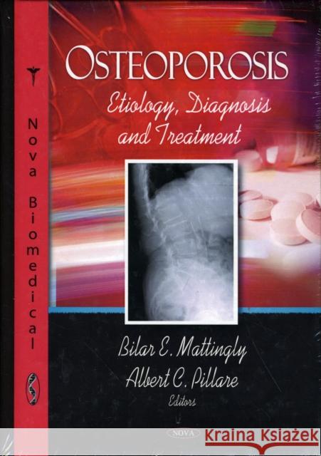 Osteoporosis: Etiology, Diagnosis & Treatment Bilar E Mattingly, Albert C Pillare 9781606923979 Nova Science Publishers Inc - książka