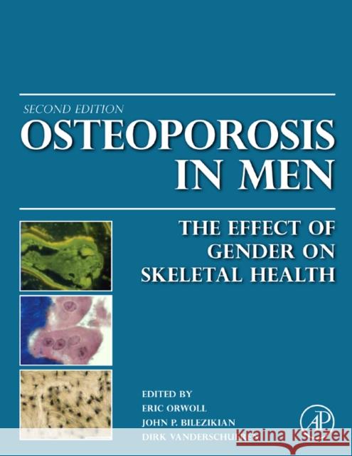 Osteoporosis in Men: The Effects of Gender on Skeletal Health Orwoll, Eric S. 9780123746023  - książka