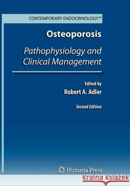 Osteoporosis: Pathophysiology and Clinical Management Adler, Robert A. 9781617795183 Contemporary Endocrinology - książka