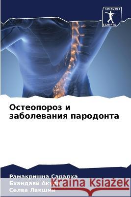 Osteoporoz i zabolewaniq parodonta Saradha, Ramakrishna, Akula, Bhandawi, Lakshmi, Selwa 9786206236399 Sciencia Scripts - książka