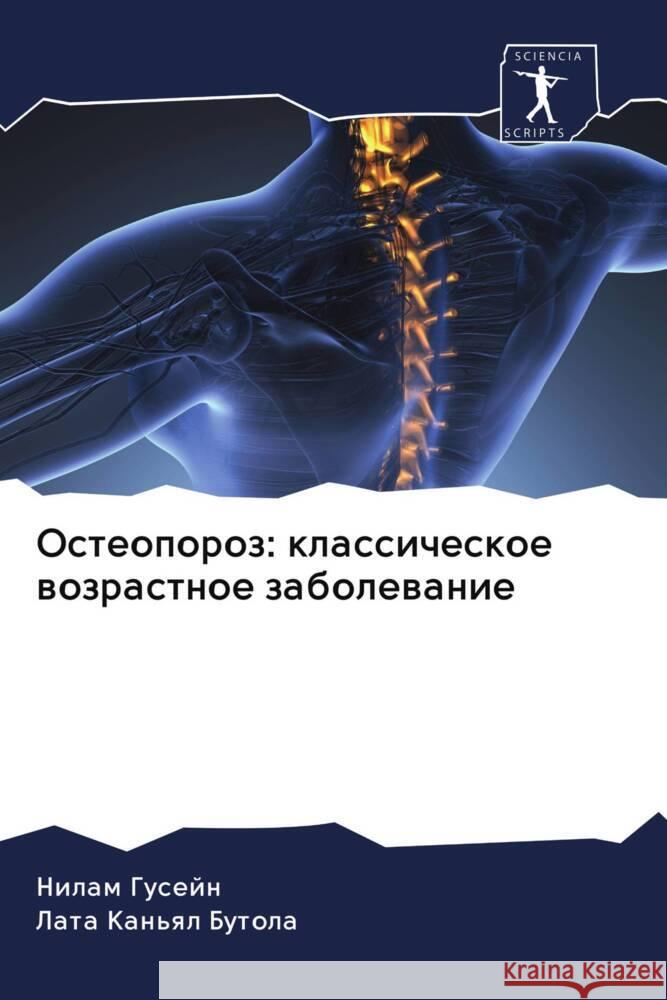 Osteoporoz: klassicheskoe wozrastnoe zabolewanie Gusejn, Nilam, Kan'ql Butola, Lata 9786203022476 Sciencia Scripts - książka