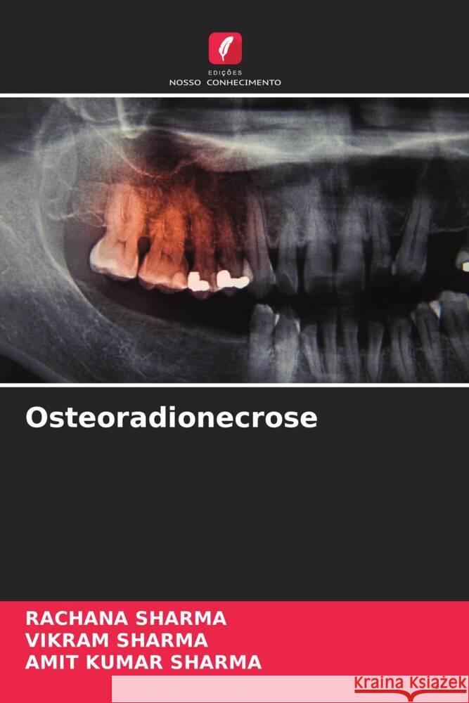 Osteoradionecrose Rachana Sharma Vikram Sharma Amit Kumar Sharma 9786208161316 Edicoes Nosso Conhecimento - książka