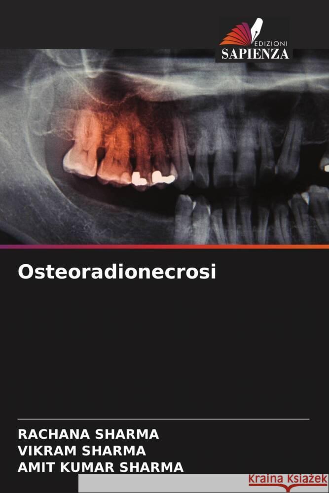 Osteoradionecrosi Rachana Sharma Vikram Sharma Amit Kumar Sharma 9786208161330 Edizioni Sapienza - książka