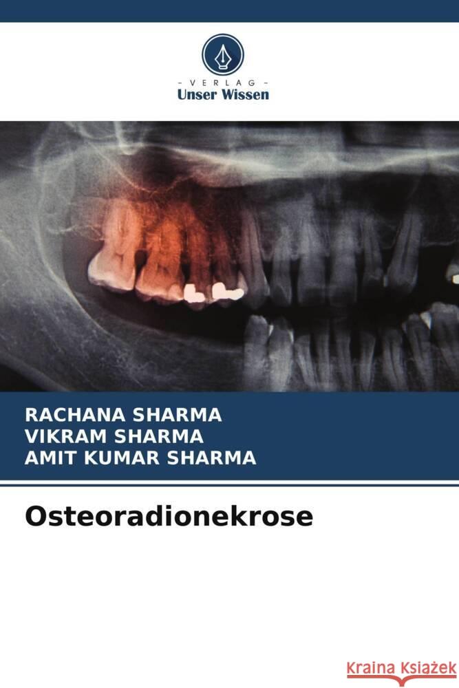 Osteoradionekrose Rachana Sharma Vikram Sharma Amit Kumar Sharma 9786208161286 Verlag Unser Wissen - książka