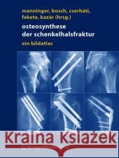 Osteosynthese der schenkelhalsfraktur: ein bildatlas Manninger, Jenö 9783211201527 Springer - książka