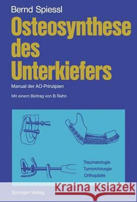 Osteosynthese Des Unterkiefers: Manual Der Ao-Prinzipien Rahn, Berton 9783642718755 Springer - książka