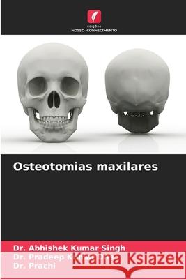 Osteotomias maxilares Singh, Dr. Abhishek Kumar, Das, Dr. Pradeep Kumar, Prachi, Dr. 9786206764649 Edições Nosso Conhecimento - książka
