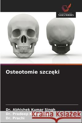 Osteotomie szczeki Singh, Dr. Abhishek Kumar, Das, Dr. Pradeep Kumar, Prachi, Dr. 9786206764687 Wydawnictwo Nasza Wiedza - książka