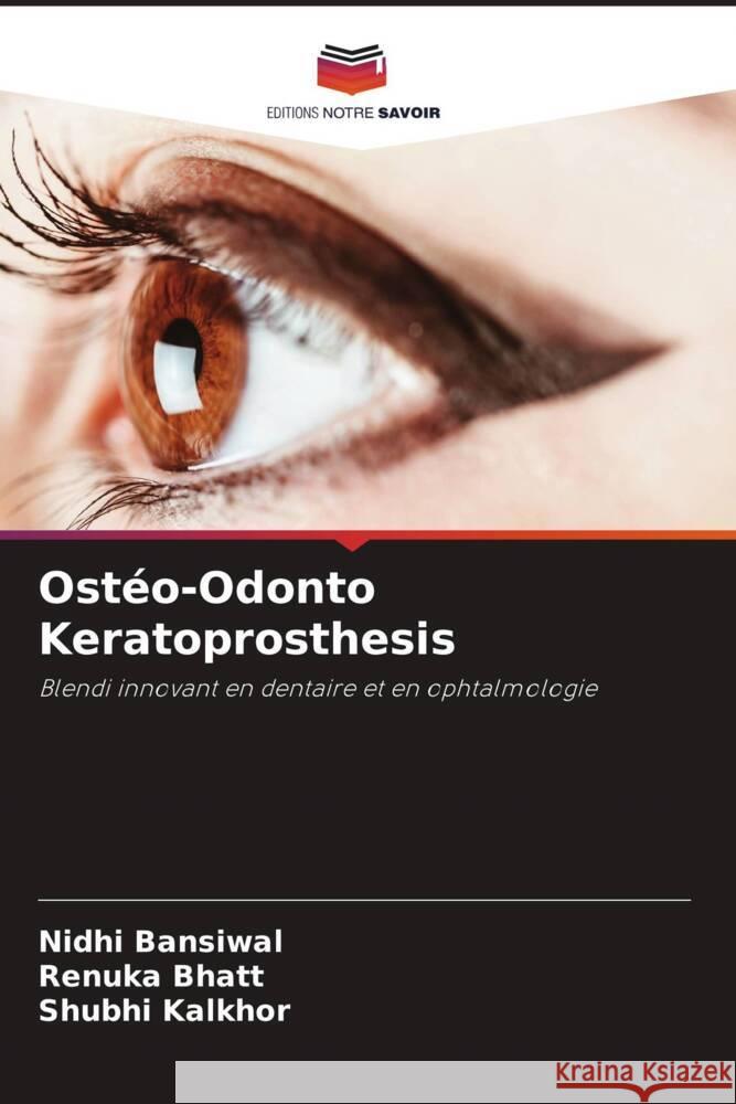 Ostéo-Odonto Keratoprosthesis Bansiwal, Nidhi, Bhatt, Renuka, Kalkhor, Shubhi 9786205114261 Editions Notre Savoir - książka