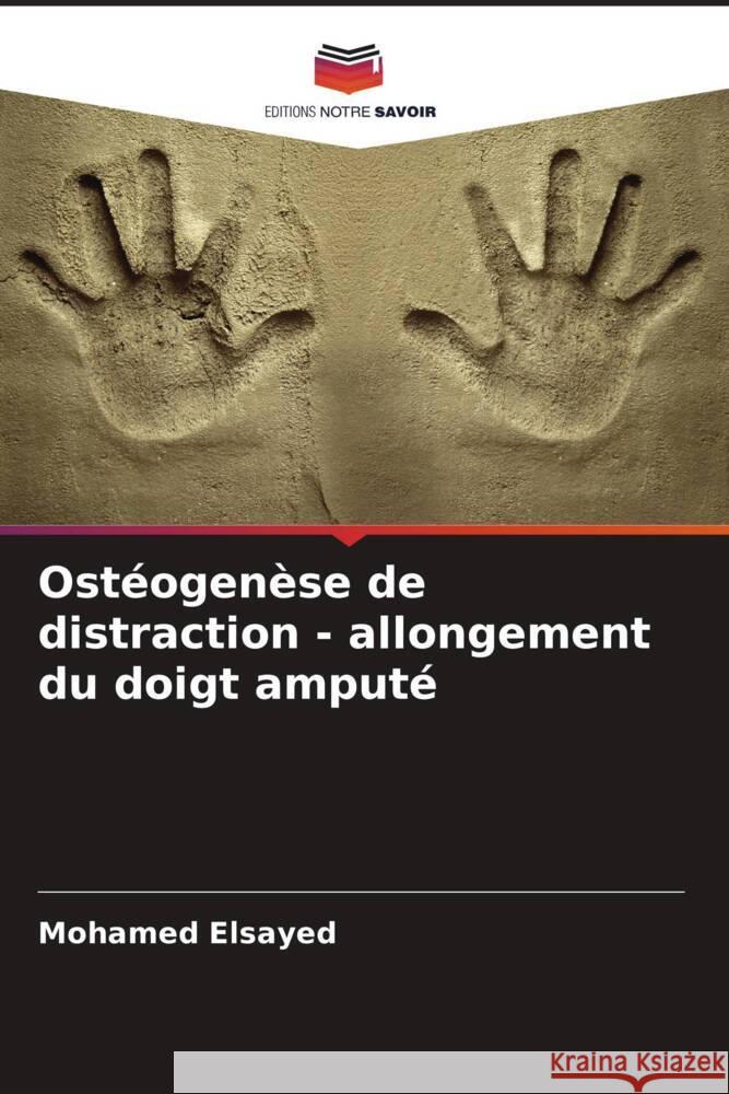 Ostéogenèse de distraction - allongement du doigt amputé Elsayed, Mohamed 9786208199159 Editions Notre Savoir - książka