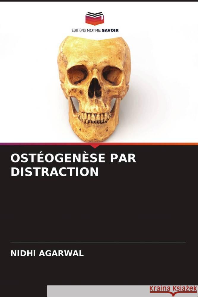 OSTÉOGENÈSE PAR DISTRACTION Agarwal, Nidhi 9786205184486 Editions Notre Savoir - książka