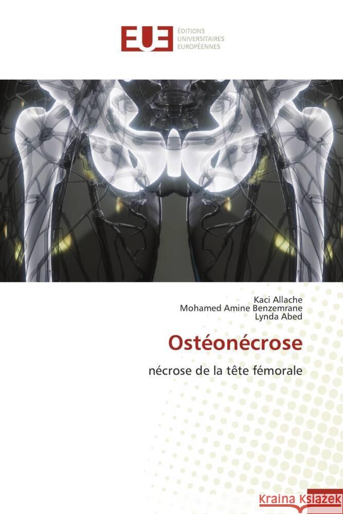 Ostéonécrose Allache, Kaci, Benzemrane, Mohamed Amine, Abed, Lynda 9786138424147 Éditions universitaires européennes - książka