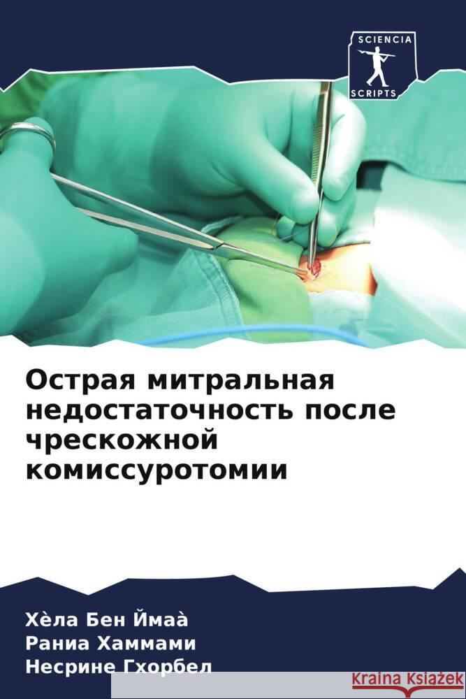 Ostraq mitral'naq nedostatochnost' posle chreskozhnoj komissurotomii Ben Jmaà, Hèla, HAMMAMI, Rania, Ghorbel, Nesrine 9786208253554 Sciencia Scripts - książka