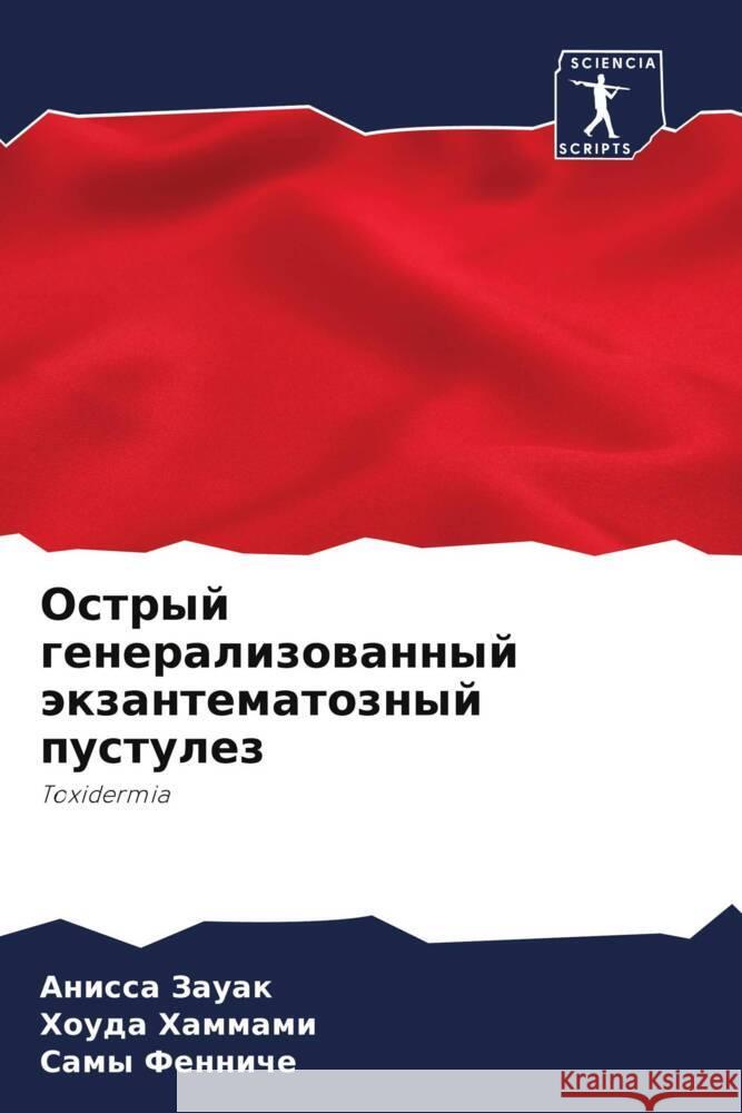 Ostryj generalizowannyj äkzantematoznyj pustulez Zauak, Anissa, Hammami, Houda, Fenniche, Samy 9786208041984 Sciencia Scripts - książka