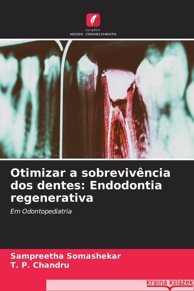 Otimizar a sobreviv?ncia dos dentes: Endodontia regenerativa Sampreetha Somashekar T. P. Chandru 9786208107758 Edicoes Nosso Conhecimento - książka