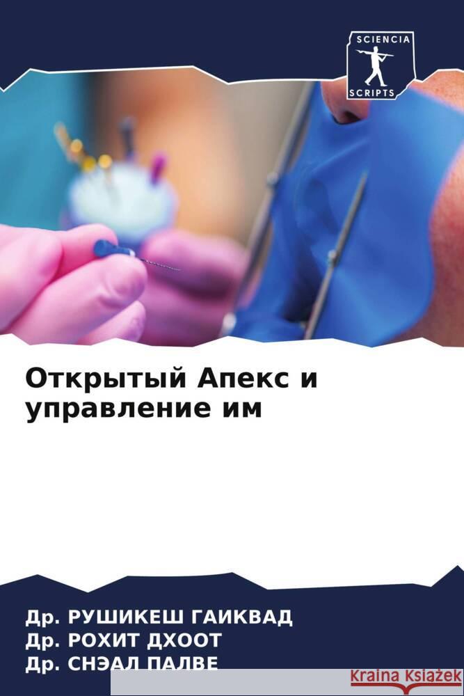 Otkrytyj Apex i uprawlenie im GAIKVAD, Dr. RUShIKESh, Dhoot, Dr. Rohit, PALVE, Dr. SNJeAL 9786208110130 Sciencia Scripts - książka