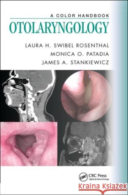 Otolaryngology: A Color Handbook  9781482253764 Apple Academic Press - książka