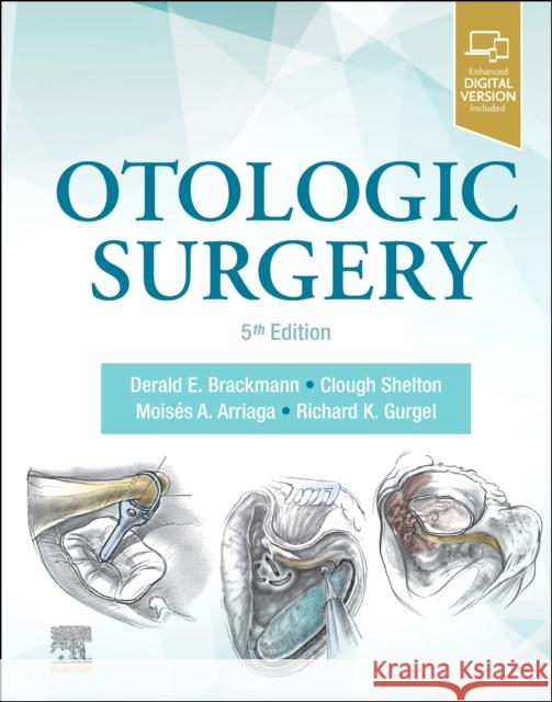 Otologic Surgery Derald Brackmann Clough Shelton Moses A. Arriaga 9780323694278 Elsevier - książka