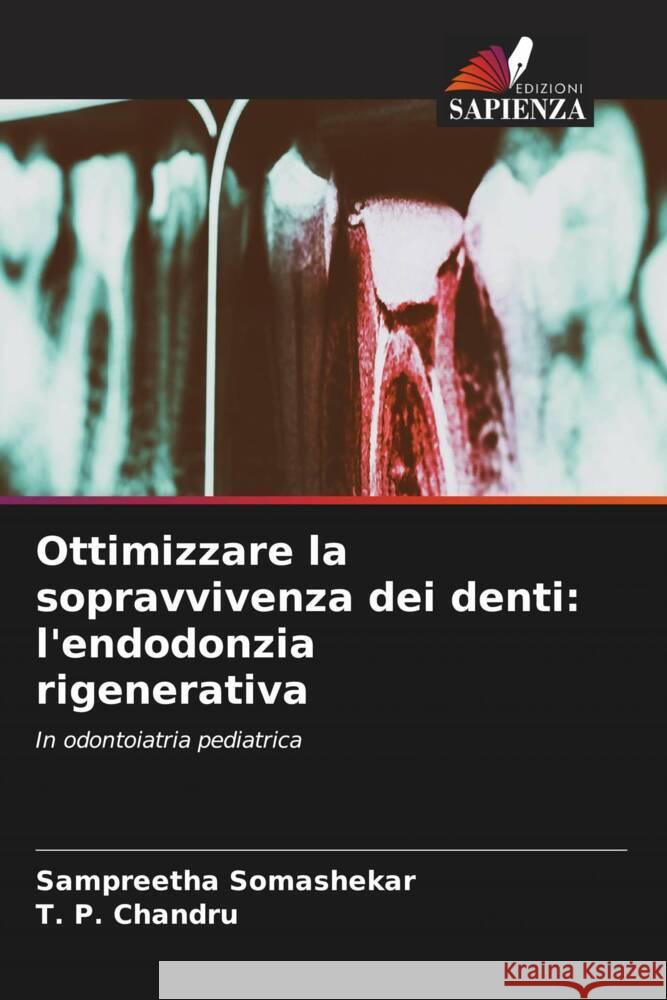 Ottimizzare la sopravvivenza dei denti: l'endodonzia rigenerativa Sampreetha Somashekar T. P. Chandru 9786208107819 Edizioni Sapienza - książka